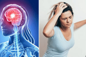 Cảnh báo bệnh đột quỵ ngày càng trẻ hóa