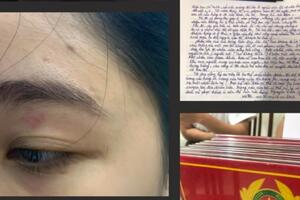 Hành hung thực khách tại tiệm bánh mỳ Nguyễn Sinh: Hai nhân viên bị phạt 13 triệu đồng