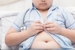 Thế giới có nhiều trẻ thừa cân hơn trẻ thiếu cân