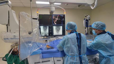 Bệnh viện Đa khoa tỉnh Hà Giang can thiệp cấp cứu thành công ca bệnh vỡ phình động mạch não