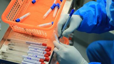 Việt Nam sẽ có vaccine Tả lợn châu Phi vào năm 2022