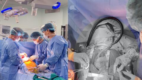 CorHeart 6-hy vọng mới cho bệnh nhân suy tim giai đoạn cuối