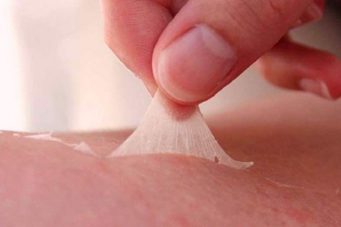 Nguy cơ bệnh da và bỏng da do thời tiết nắng nóng